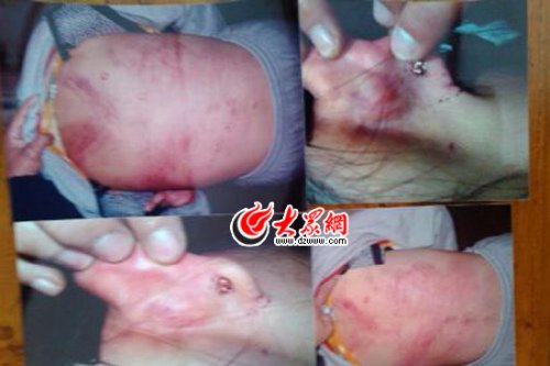 　山東藝術(shù)設(shè)計學院16歲女生宿舍內(nèi)被女同學暴打4小時。