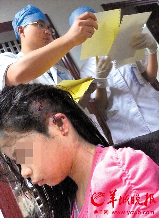 受傷的11歲女孩頭發(fā)被卷入扶梯，耳朵被嚴(yán)重拉傷，需手術(shù)。