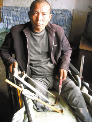 鄭艷良就是用這幾樣簡陋工具，給自己做了右腿截肢手術(shù)。