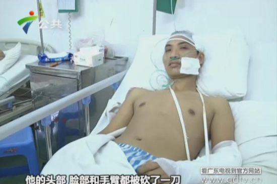 另一名傷者頭部、臉部和手臂都被砍了一刀。(視頻截圖)