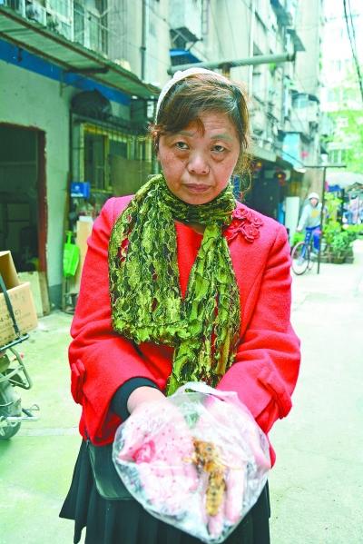 頭部受傷的黃女士展示兩根大魚刺。
