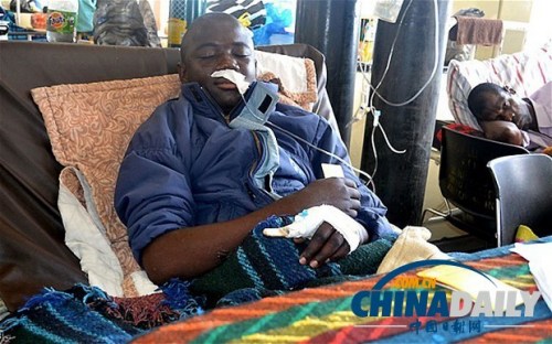 雖然已經(jīng)在醫(yī)院接受了近一個月的恢復(fù)治療，卡托卡的身體仍然非常虛弱。
