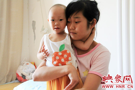 孩子和媽媽在一起，她的右眼已經(jīng)失明。