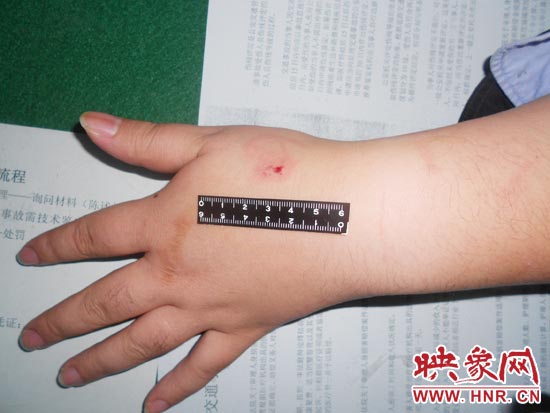 為幫助無證駕駛的朋友逃避處罰，新鄉(xiāng)的王某竟對執(zhí)勤民警大打出手，還將一名民警的手臂咬傷