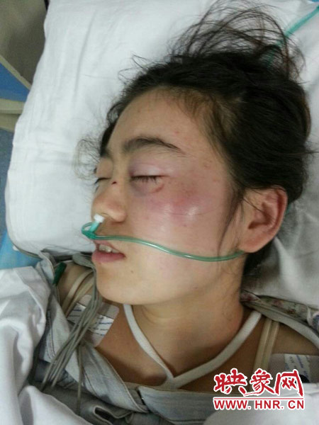 9月10日晚,被暴打的小陳出現(xiàn)了間歇性昏迷,被送進(jìn)了省人民醫(yī)院。