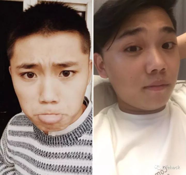 長胖20斤，臉型怎么變？這些例子看完扎心了！