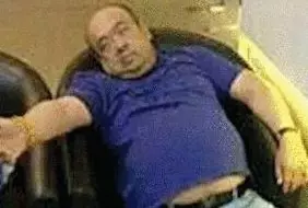 網傳金正男中毒后的照片。