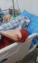 砸窗當(dāng)事人胡女士在醫(yī)院接受治療。
