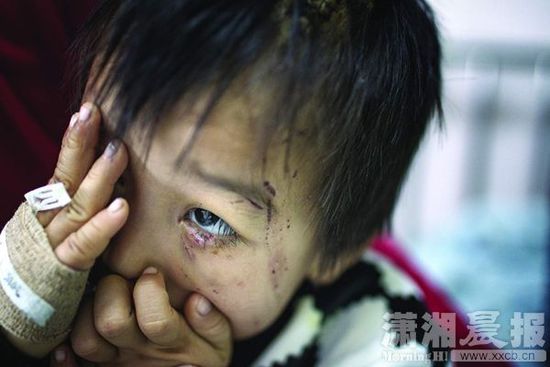 1月13日，湖南省兒童醫(yī)院，4歲的源源用手蒙住了眼睛。