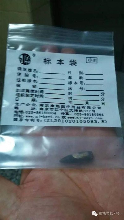 經警方鑒定，秦女士體內取出的子彈系56式步槍射出 。 受訪者供圖