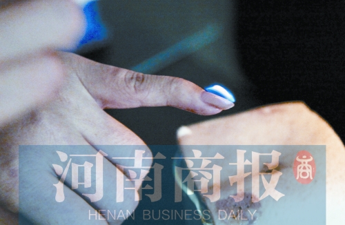 將指甲油涂在指甲上，靠近火焰時被引燃了