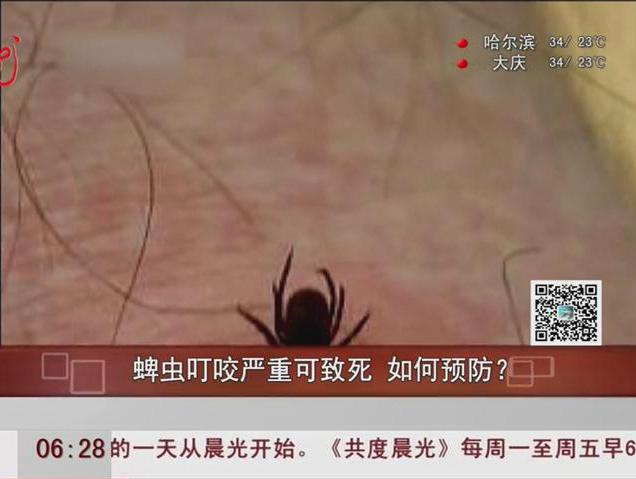 蜱蟲叮咬嚴(yán)重可致死如何預(yù)防？